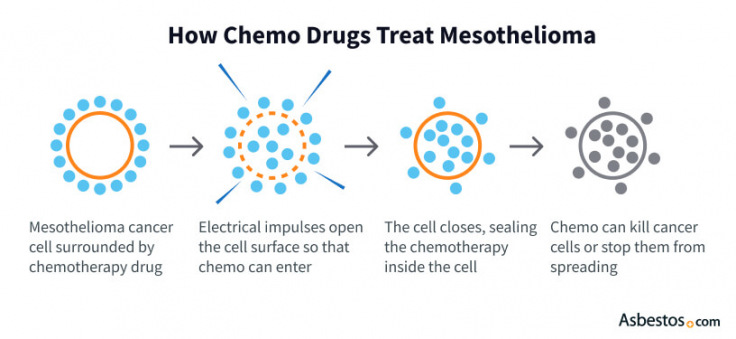Diagram showing how chemotherapy treats mesothelioma: the chemo drug surrounds the mesothelioma cancer cell, electrical impulses open the cell surface so the drug enters, the cell closes and traps the drug inside, and the chemo then kills the mesothelioma cell or prevents it from spreading.