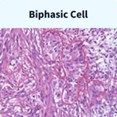 Biphasic mesothelioma cells