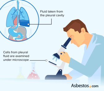 Cytology from pleural cavity