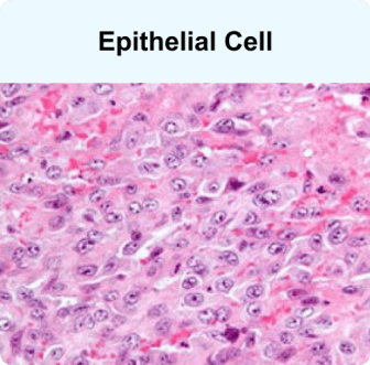 Epithelioid mesothelioma cell under microscope - uniform oval shape with clear center